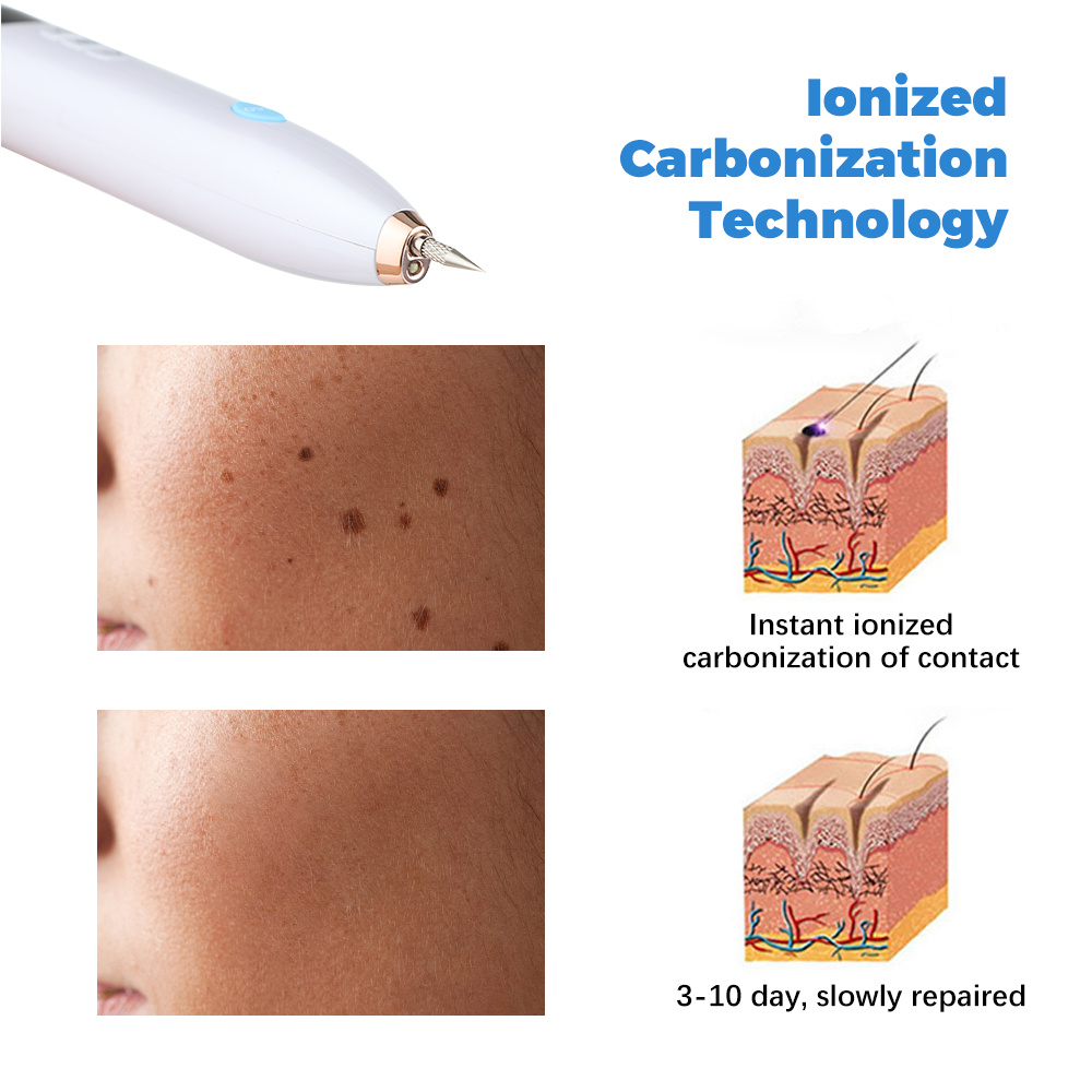 Laser Skin Tag & Mole Remover - Image 6